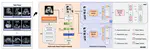 Advancing Ultrasound Medical Continuous Learning with Task-Specific Generalization and Adaptability